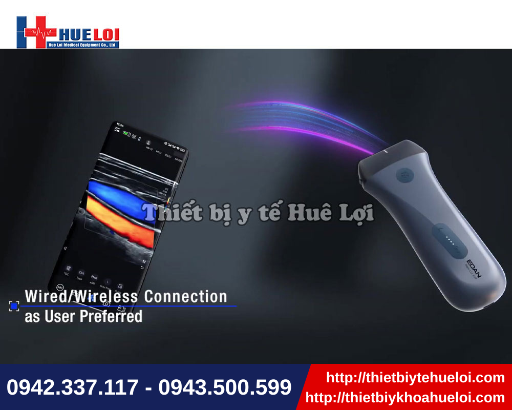 MÁY SIÊU ÂM CẦM TAY HIỆN ĐẠI EDAN NANO L12 EXP